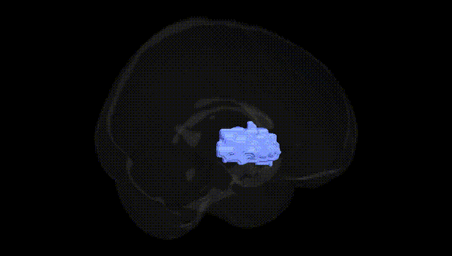 Full Brain Black