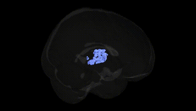 Full Brain Black