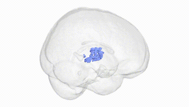 Full Brain White