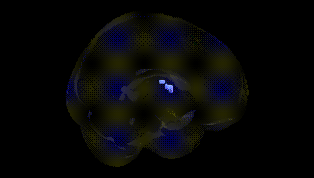 Full Brain Black