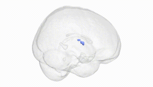Full Brain White