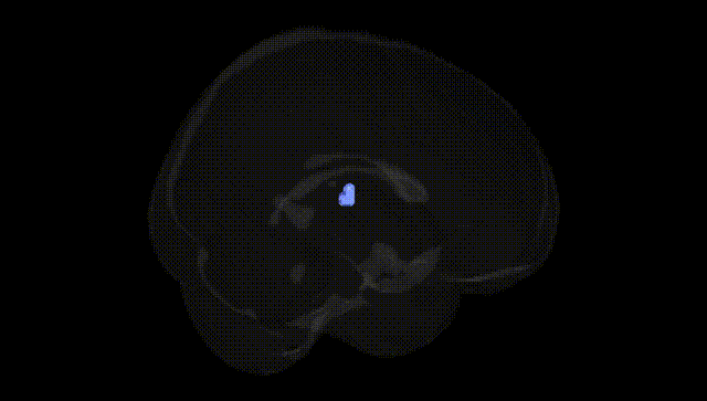 Full Brain Black