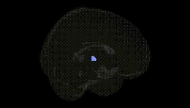 Full Brain Black