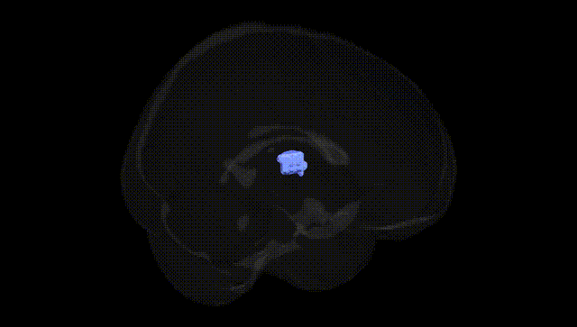 Full Brain Black