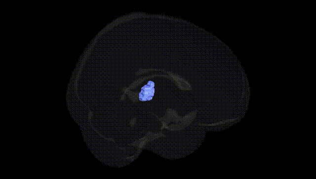 Full Brain Black