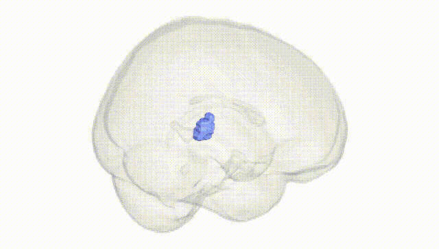 Full Brain White