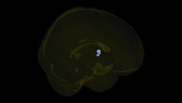 Full Brain Black