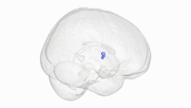 Full Brain White