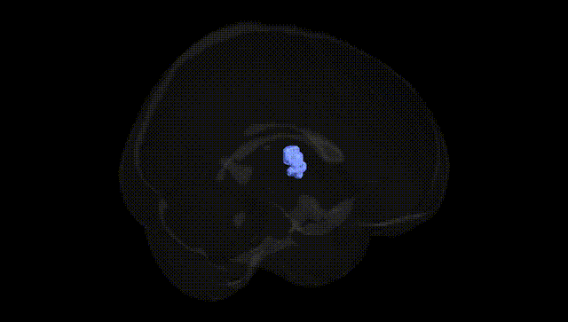 Full Brain Black