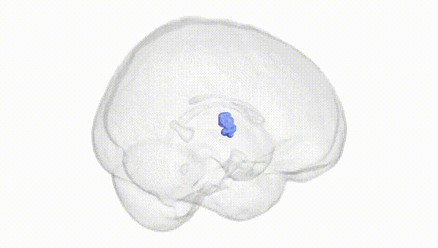 Full Brain White