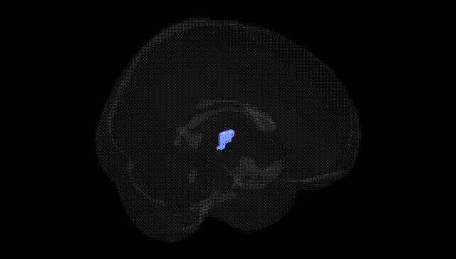 Full Brain Black
