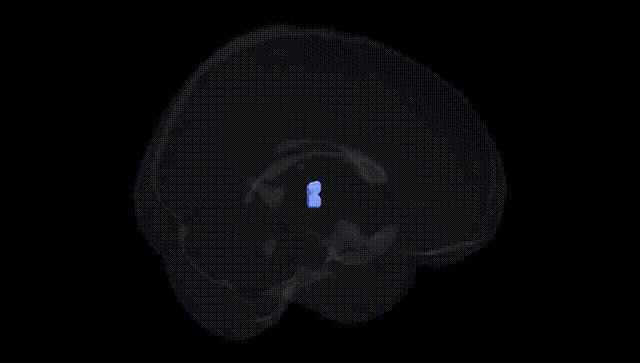 Full Brain Black