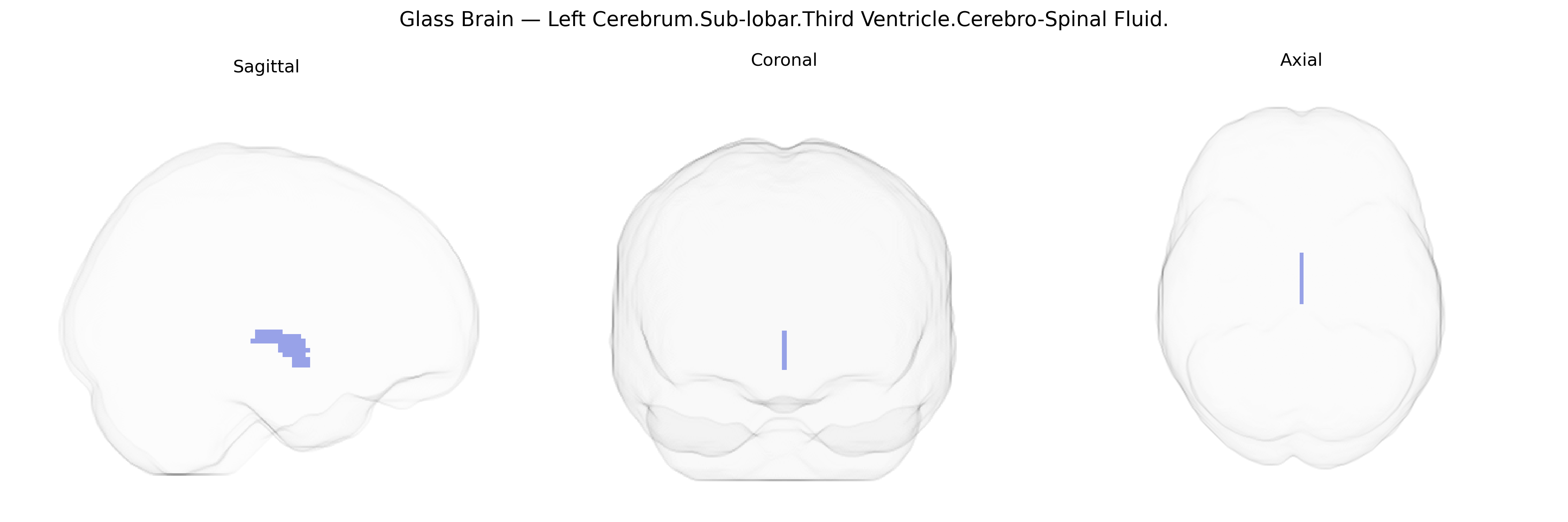 Triplanar Ghost Brain