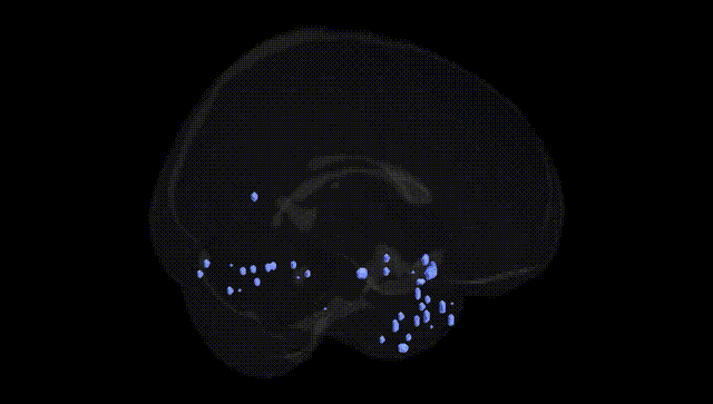 Full Brain Black