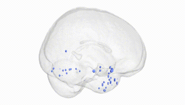 Full Brain White