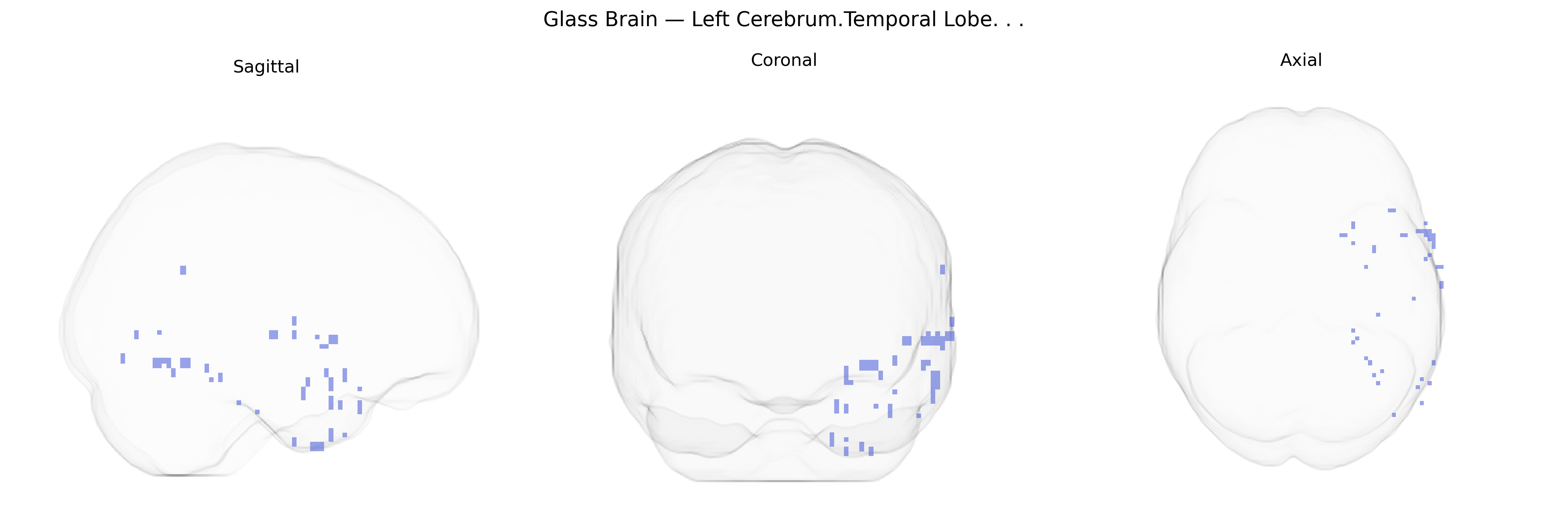 Triplanar Ghost Brain