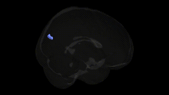 Full Brain Black