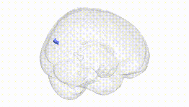 Full Brain White