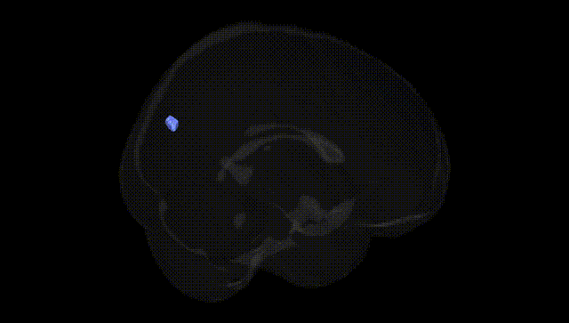 Full Brain Black