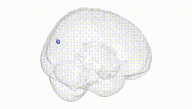 Full Brain White