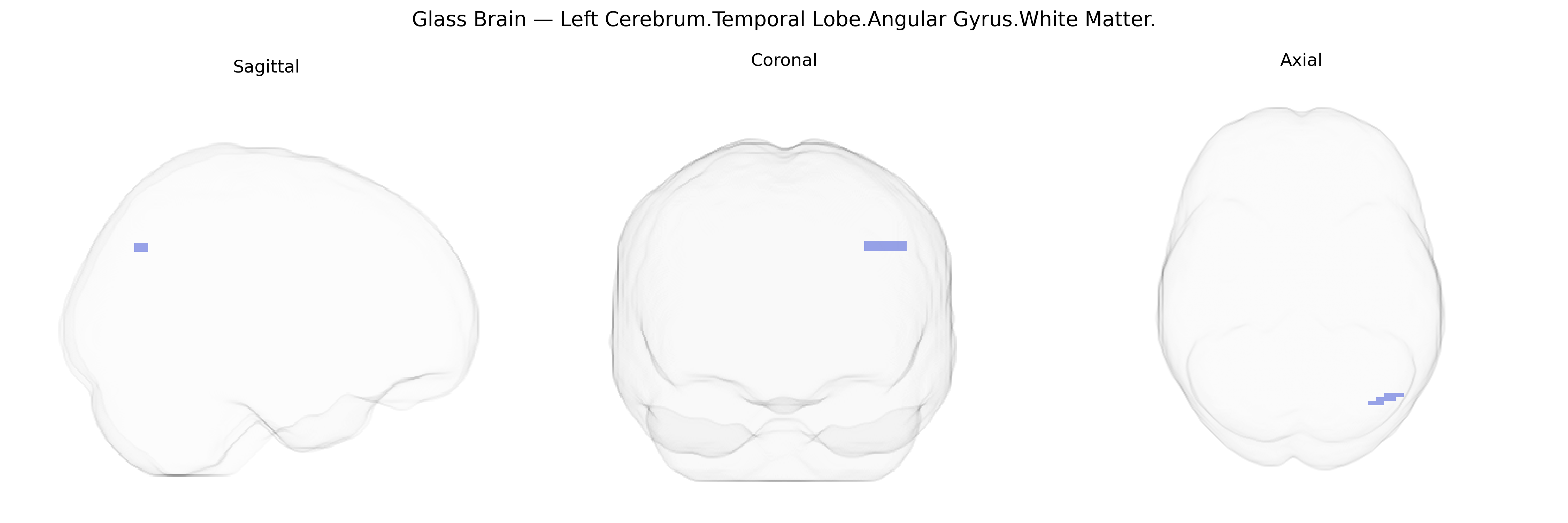 Triplanar Ghost Brain