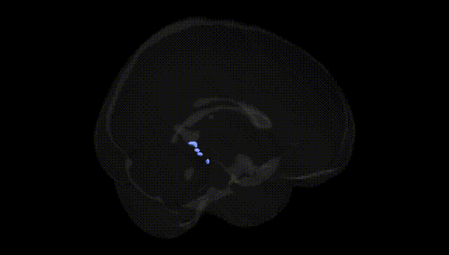 Full Brain Black