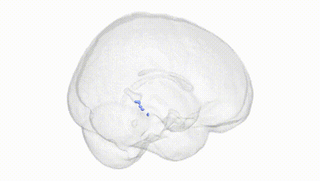 Full Brain White
