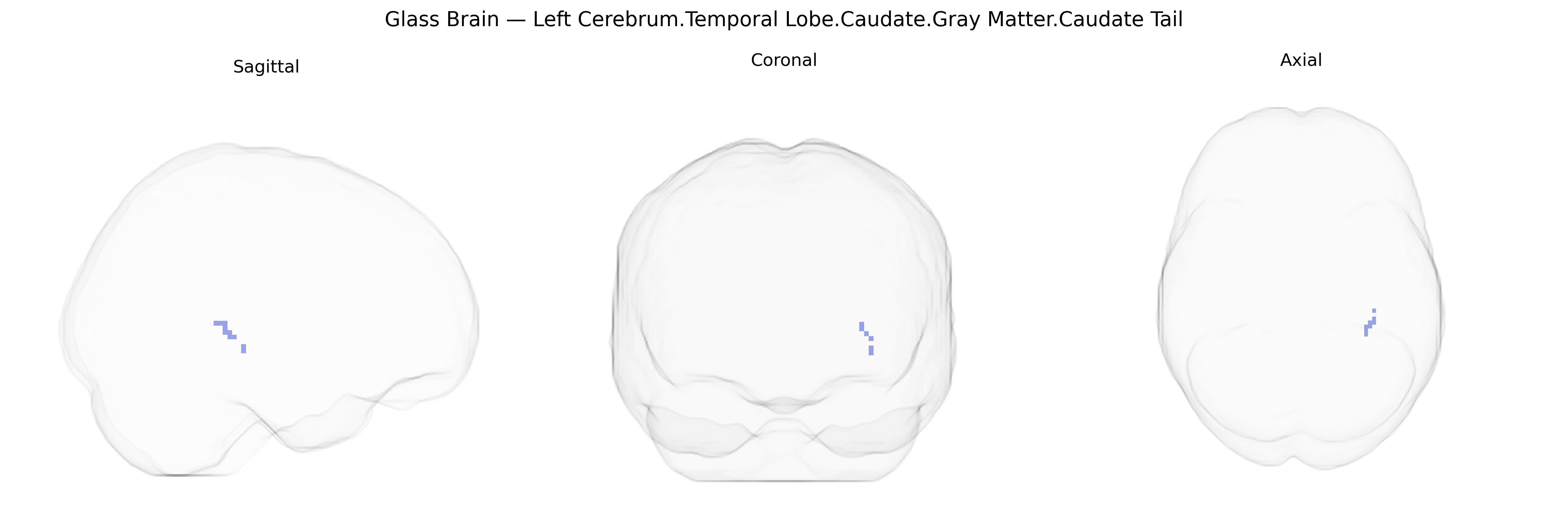 Triplanar Ghost Brain