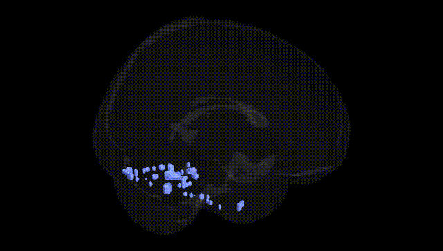 Full Brain Black