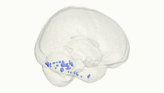 Full Brain White