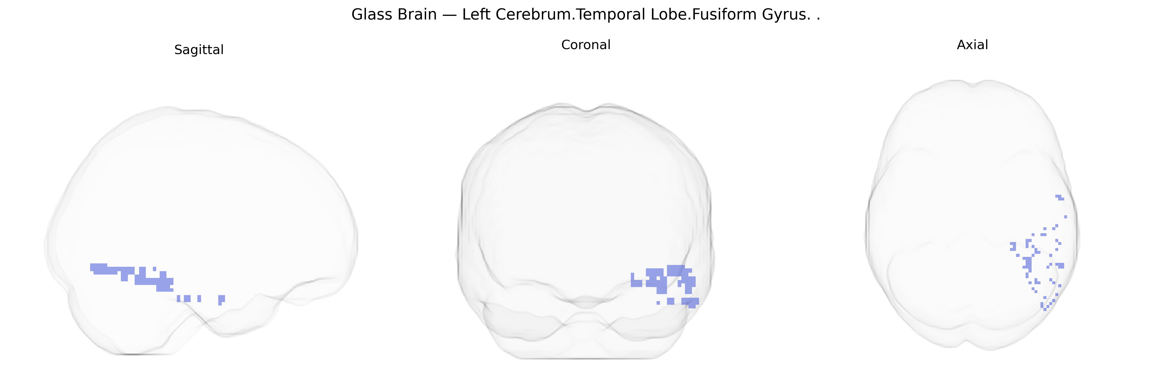 Triplanar Ghost Brain