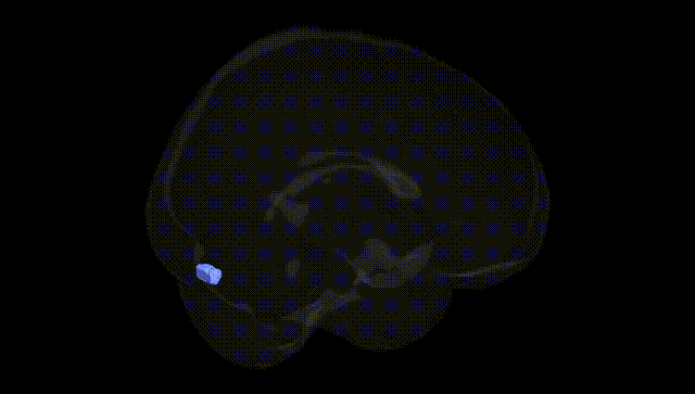 Full Brain Black