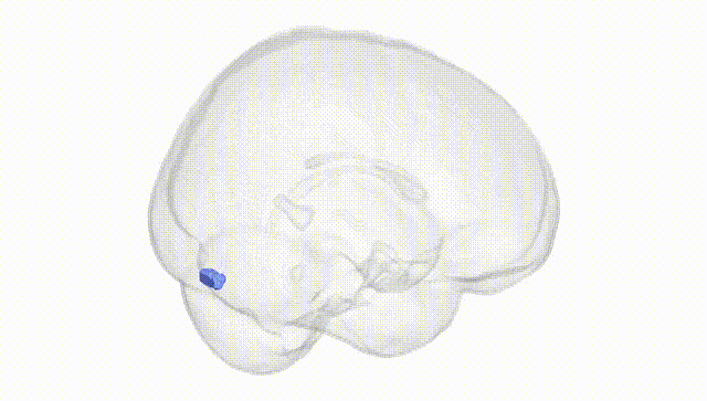 Full Brain White