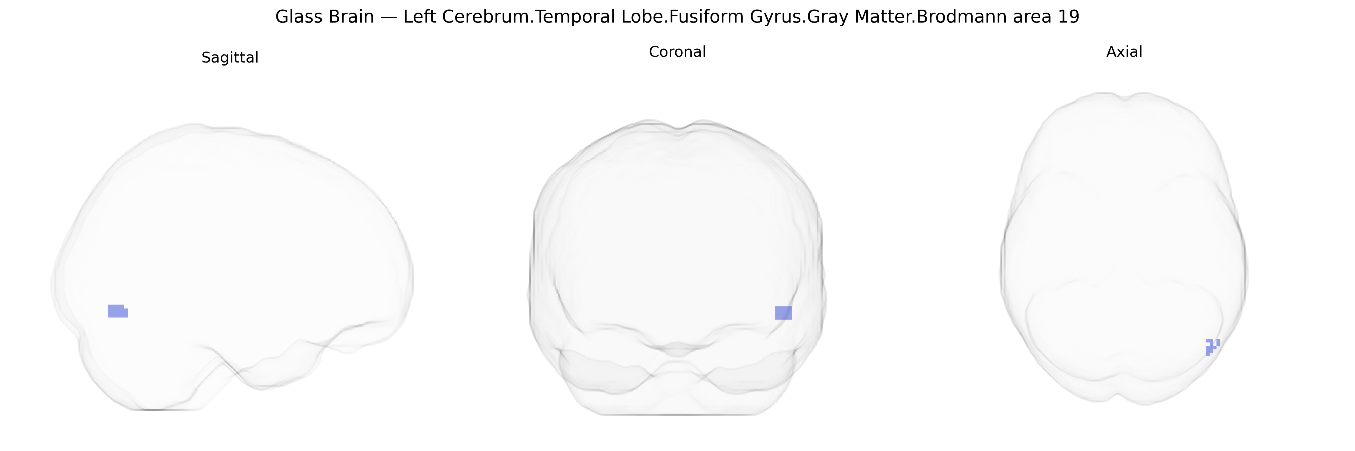 Triplanar Ghost Brain