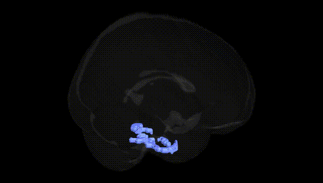 Full Brain Black