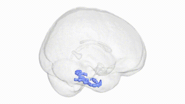 Full Brain White