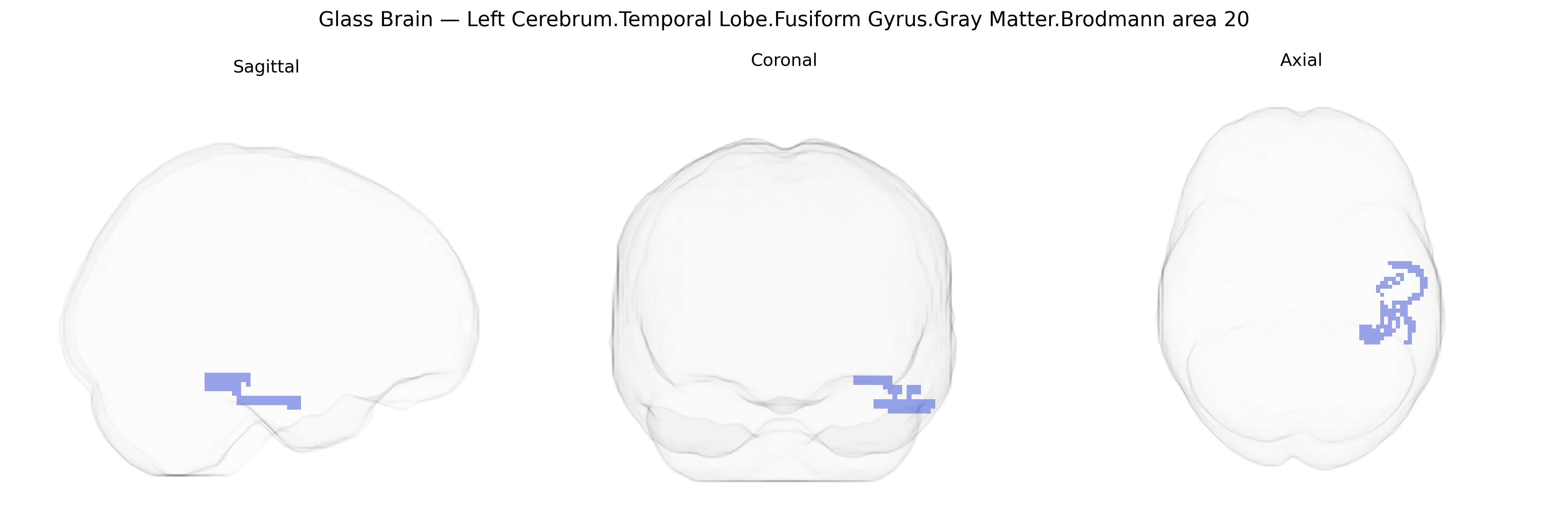 Triplanar Ghost Brain