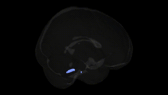 Full Brain Black