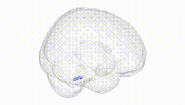 Full Brain White