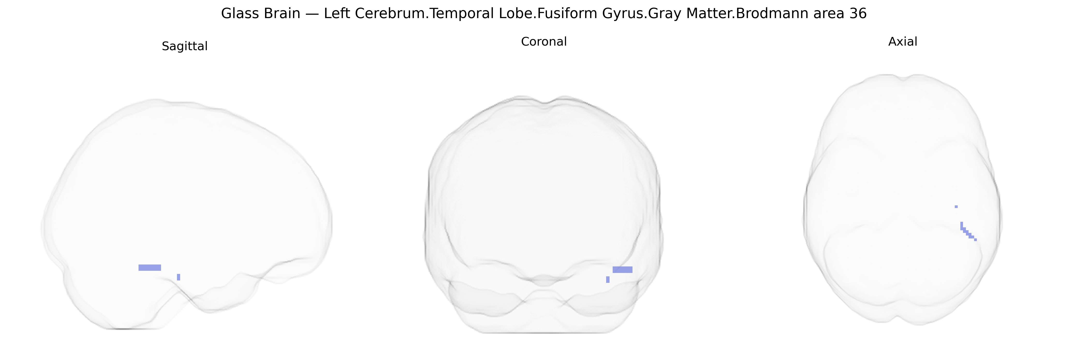 Triplanar Ghost Brain