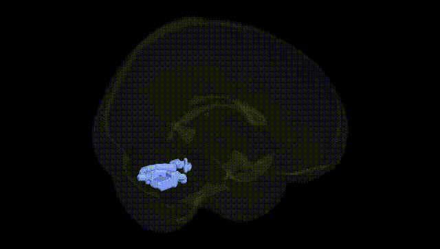 Full Brain Black