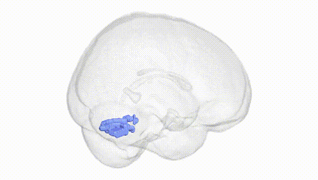 Full Brain White