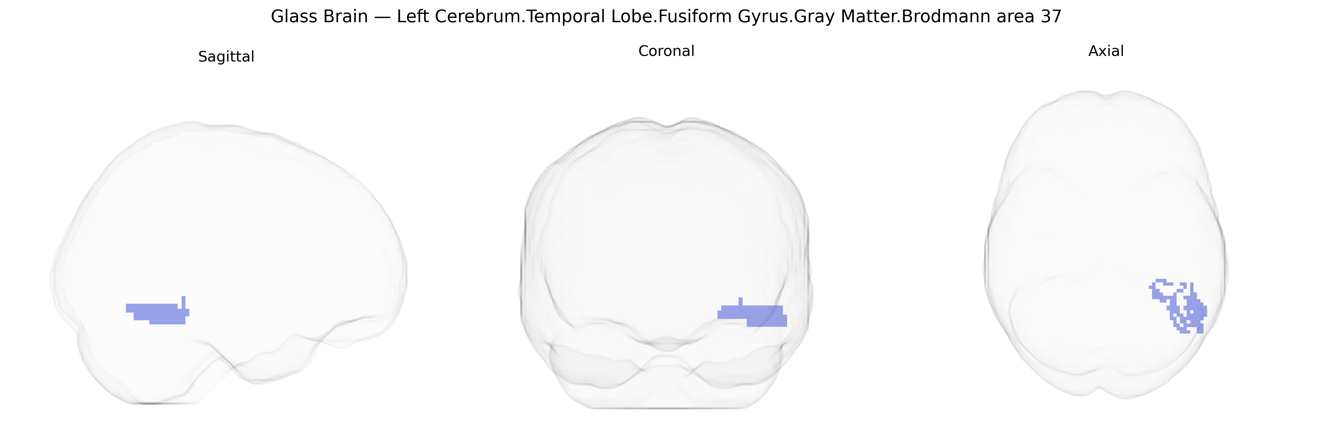 Triplanar Ghost Brain