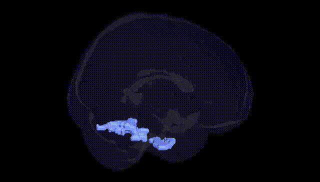 Full Brain Black