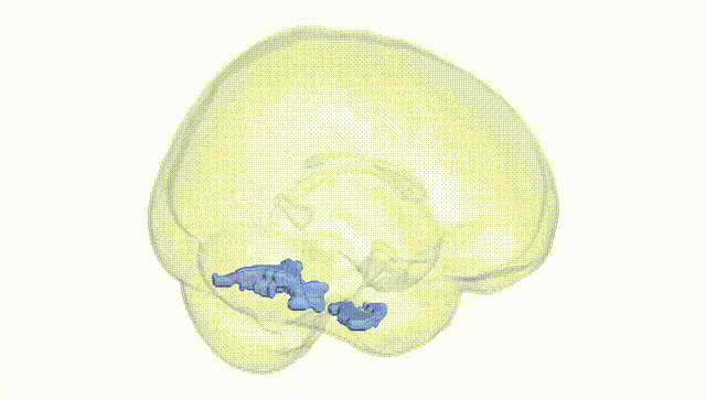 Full Brain White