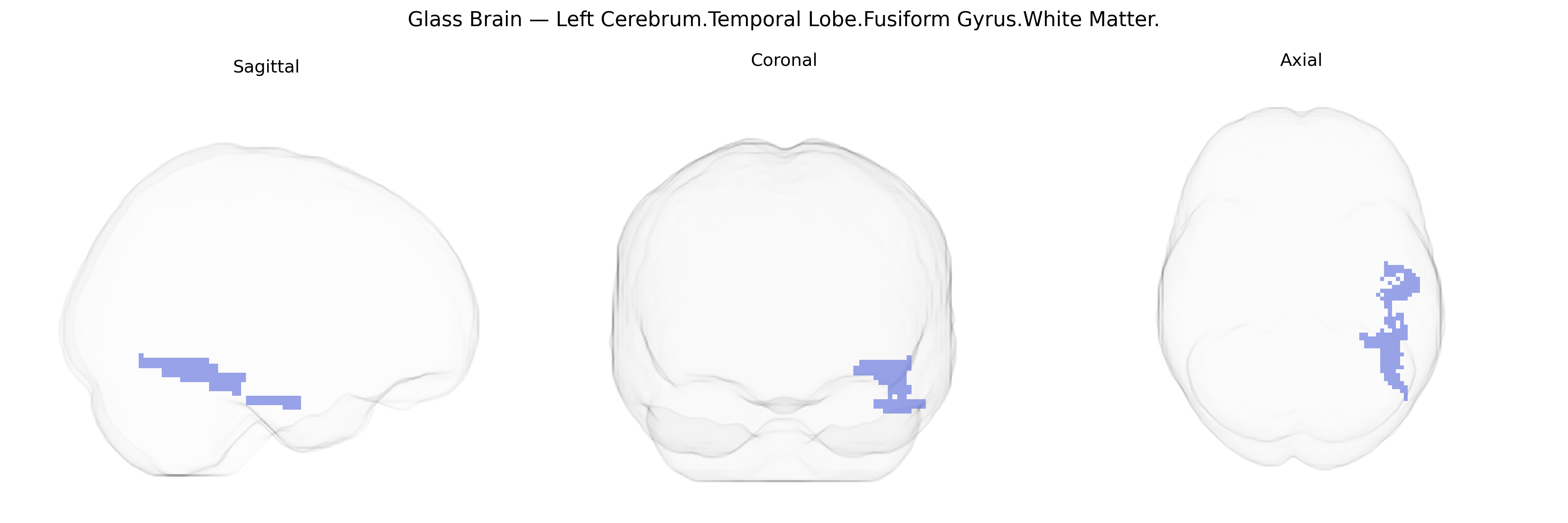 Triplanar Ghost Brain