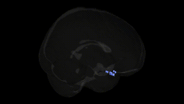 Full Brain Black