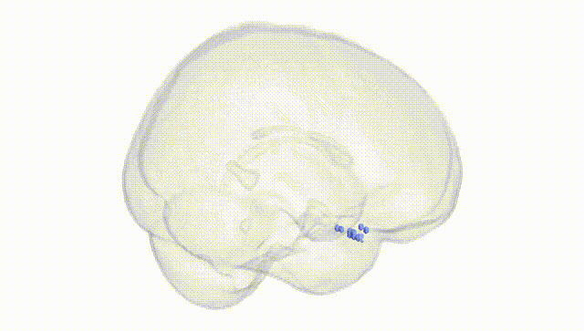 Full Brain White