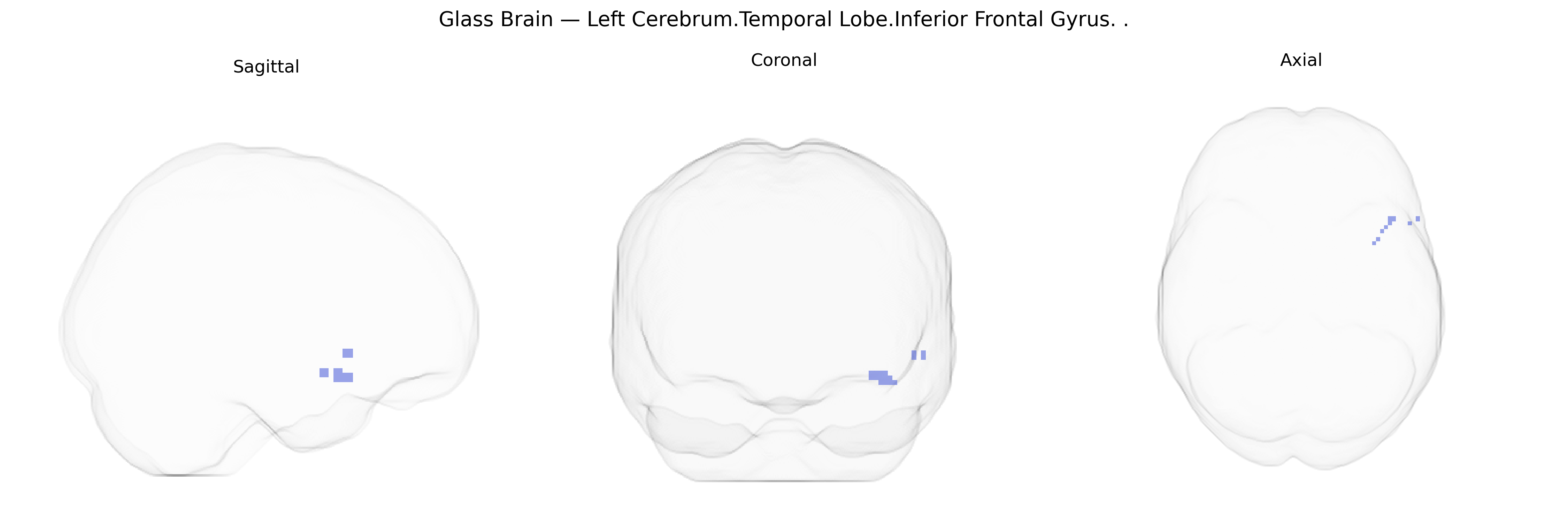 Triplanar Ghost Brain