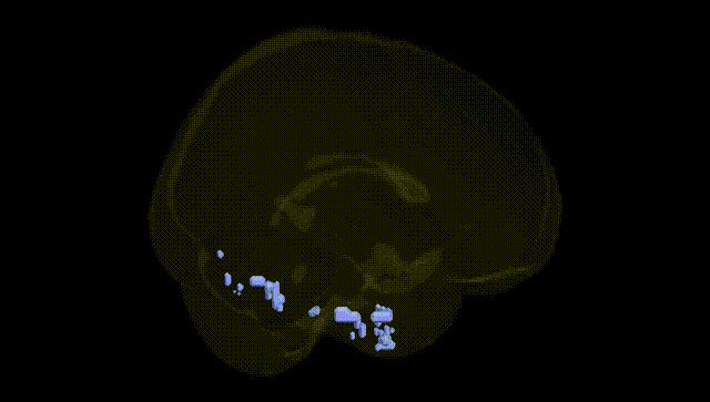 Full Brain Black